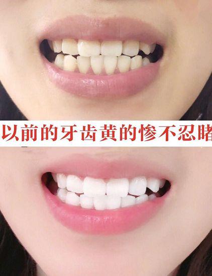 为什么口臭的人自己闻不到？教你正确做法，呼吸都是“甜”的