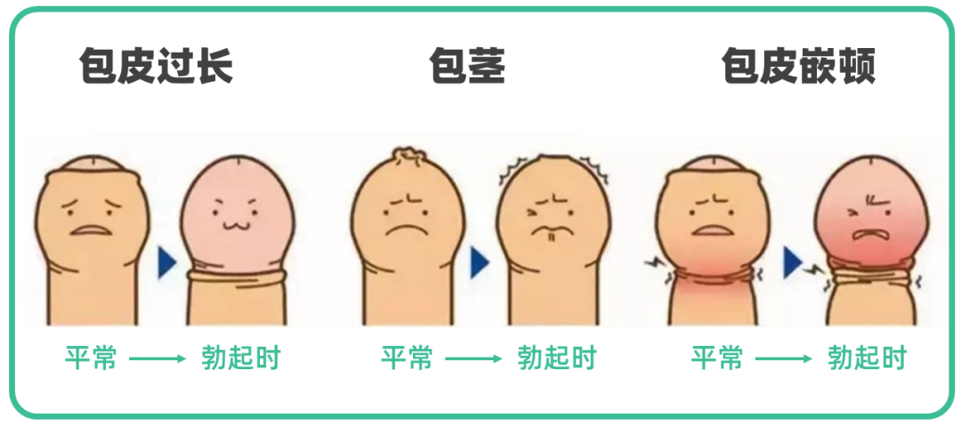 宝宝玩小JJ、包皮割不割？这9个小JJ的问题，有男宝的家长赶紧看