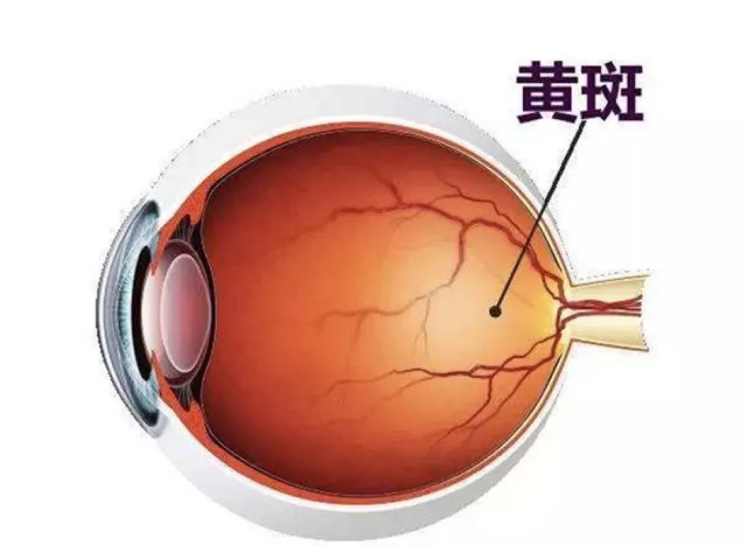 剧烈运动竟然导致眼底出血,不及时发现甚至“失明”