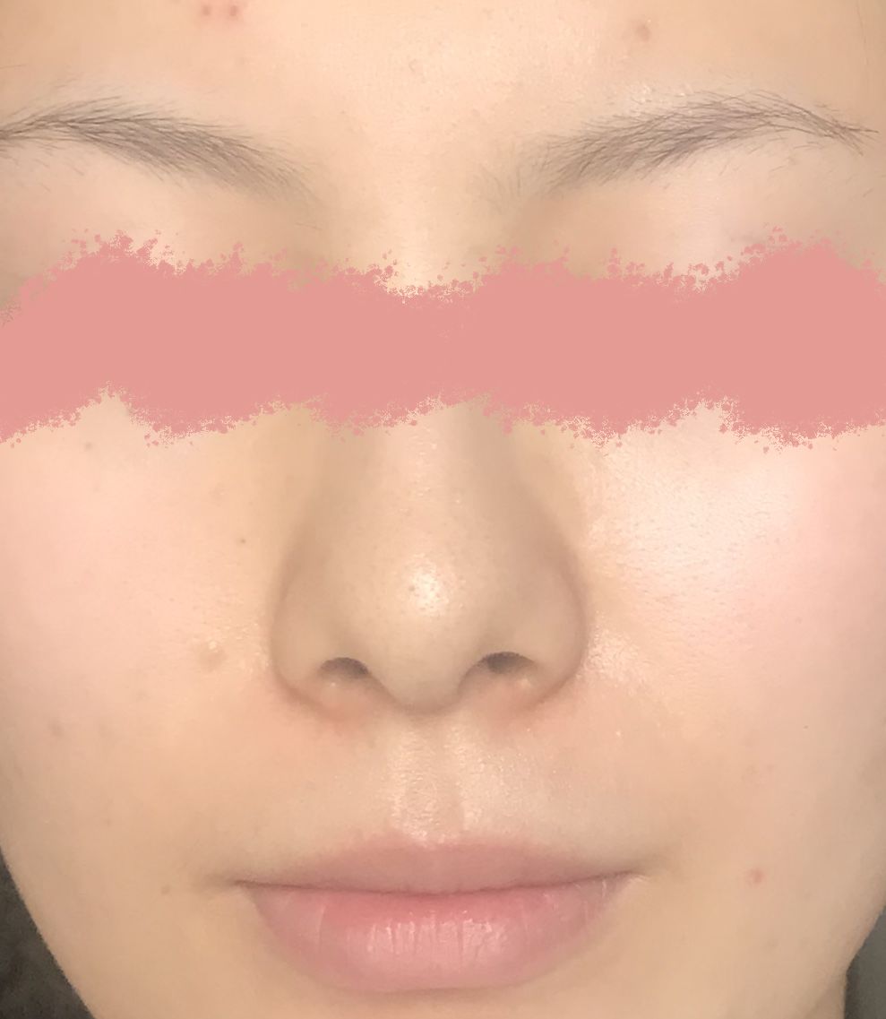 护肤实录：真情推荐，这个效果人见人爱