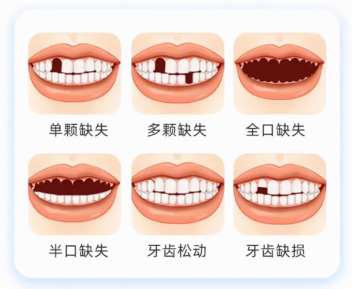 看个牙疼价格几十到几千，收费多少到底谁来决定？