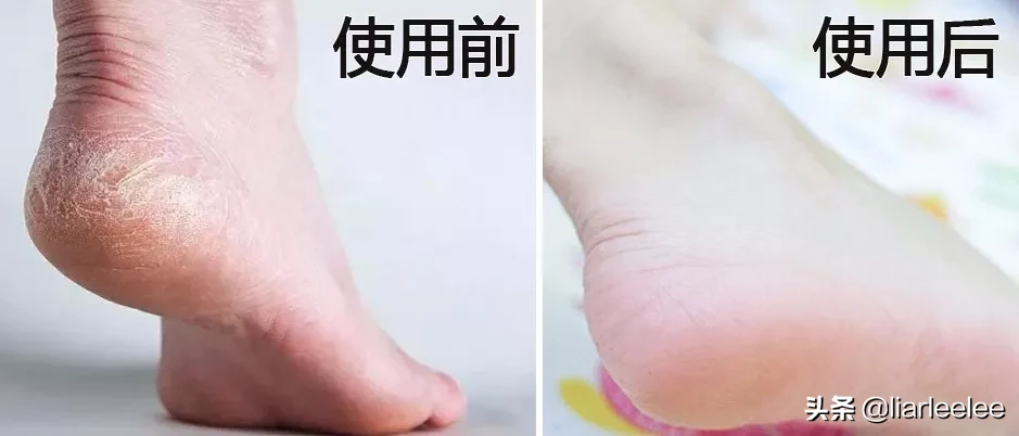 手粗糙又黄又黑？教你一个小法子，小手变的又嫩又滑更好看