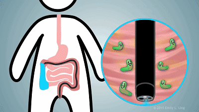 11款益生菌测评：9款无功效可言，特别不推荐汉臣氏、童年时光、昂立