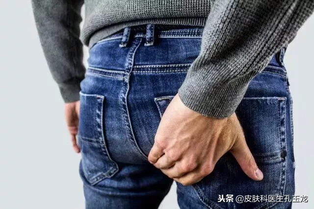 皮肤科常见疾病系列:尴尬部位的真菌感染「股癣」