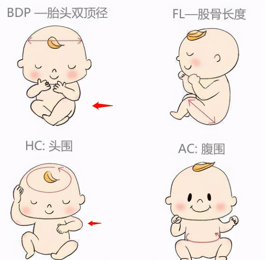 双顶径也叫"头部大横径"(bpd),指的是胎宝头部左右两侧之间最宽部位的