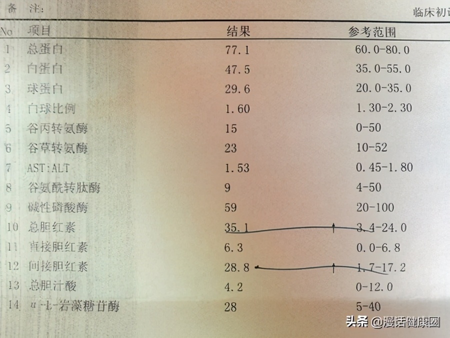 胆红素高千万别不当回事！医生告诉你实情