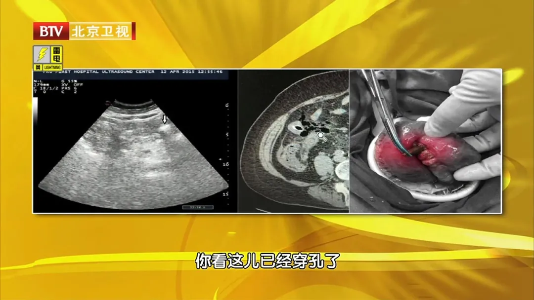 106岁老人喝了80年，脾胃健康！但很多人吃错，尤其这4种人很伤身