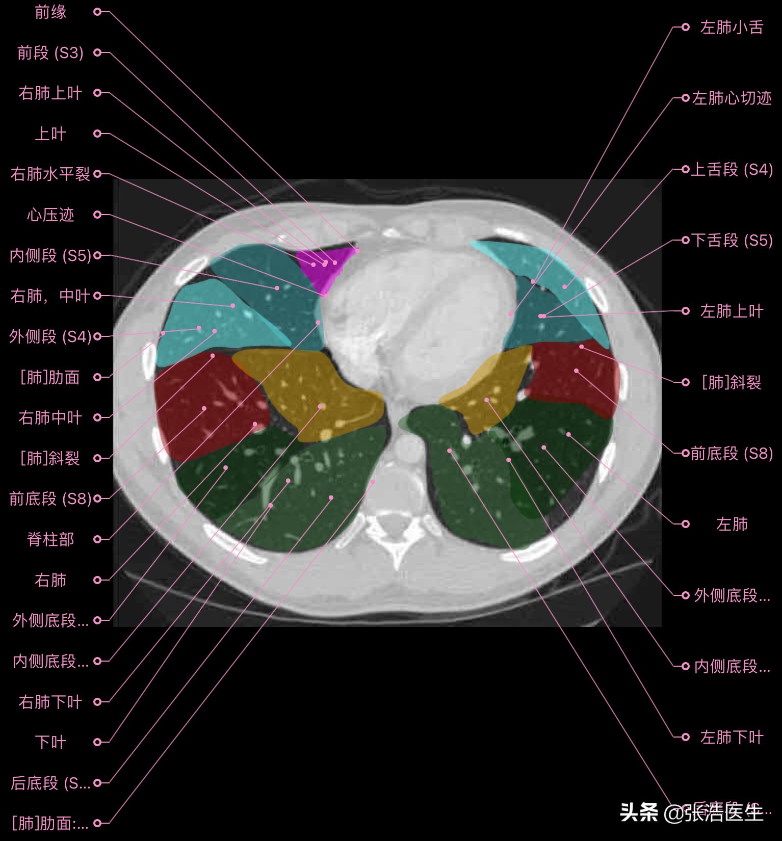 肺部ct分段解剖图图片