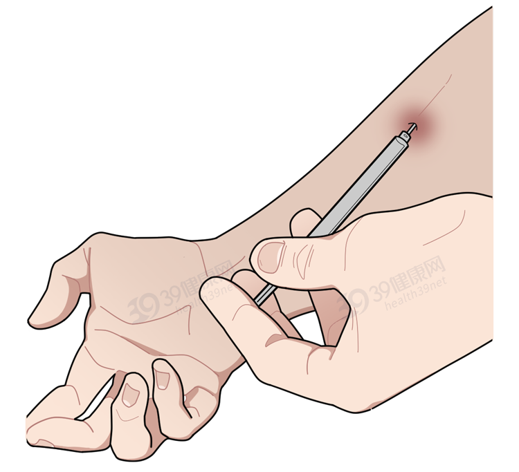 如何分辨一个人是否吸毒？看完这些吸毒者的典型症状，心里发毛