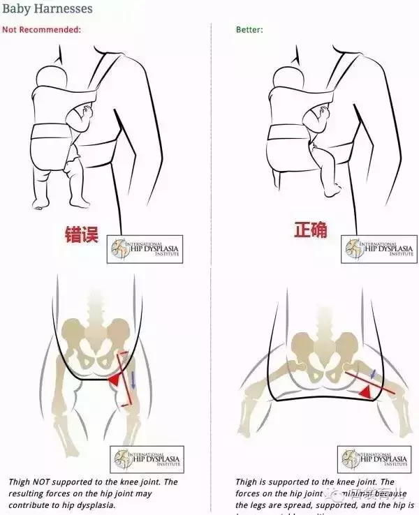 腰凳背带用对了是带娃神器，用错了是坑娃“凶器”！