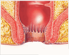 “医生，我肛门整天坠的慌，有便意还拉不出来，是咋回事？”