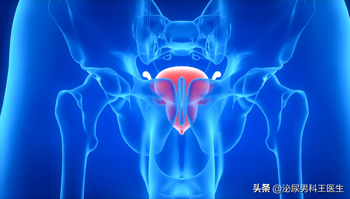 前列腺大了该怎么办——谈谈前列腺增生