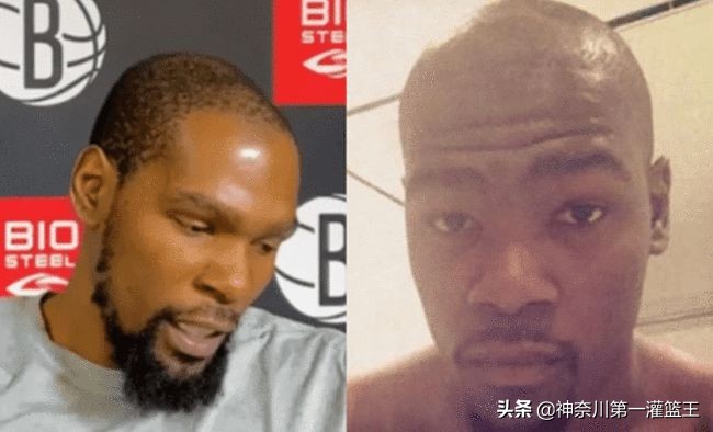 nba球星为什么要戴头套(比普通人都要强壮，为何妖刀、杜兰特和詹姆斯都会早早谢顶？)