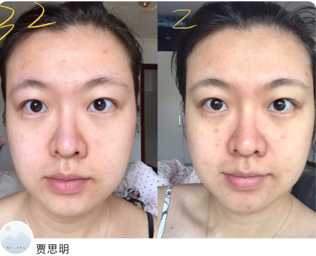 那些单用就很不错，组合起来更是神仙CP的护肤品！混搭出奇迹