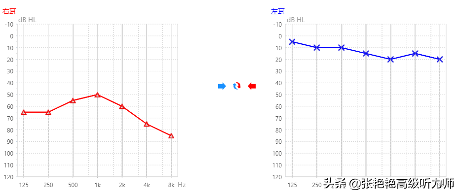 婴儿听力左耳未通过（看完单侧耳聋的4点危害）