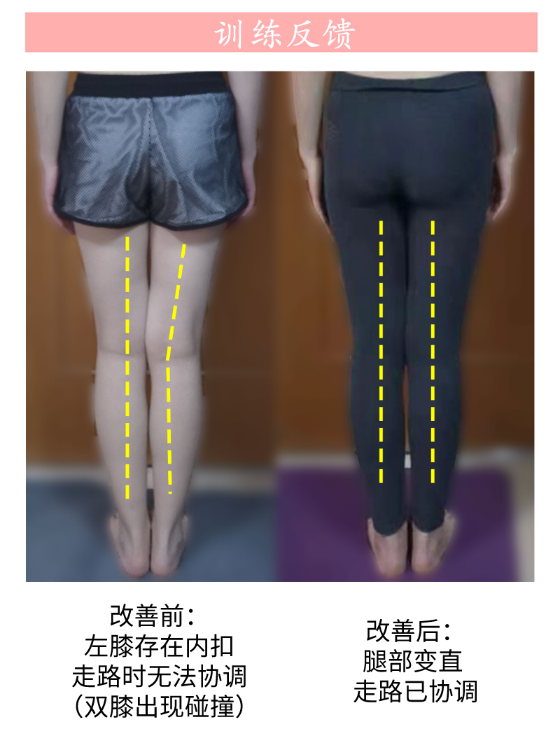 你早该清楚的！下颌歪斜、大小脸真的是由于错误的咬合关系导致？