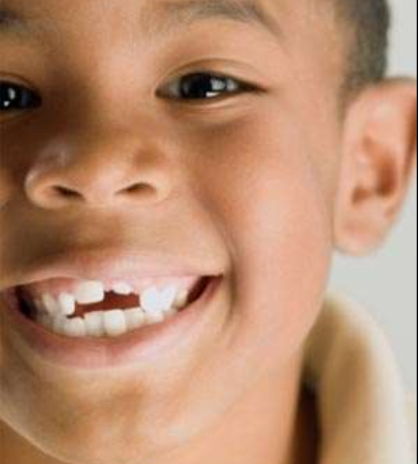 恒牙有多少颗人有多少颗乳牙和恒牙