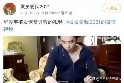 鲜肉头秃群像：千玺发际线高，王一博背头脑门亮，华晨宇被曝植发