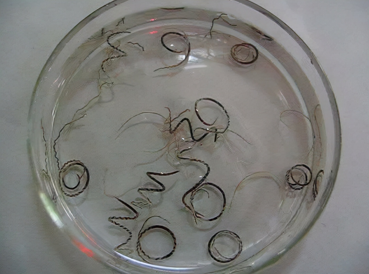 "寄生虫"警告!看到这种"蜗牛",千万不要碰