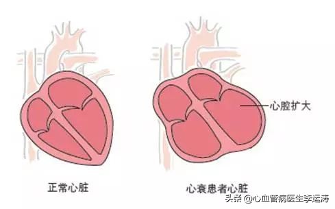 心肌标志物BNP图片