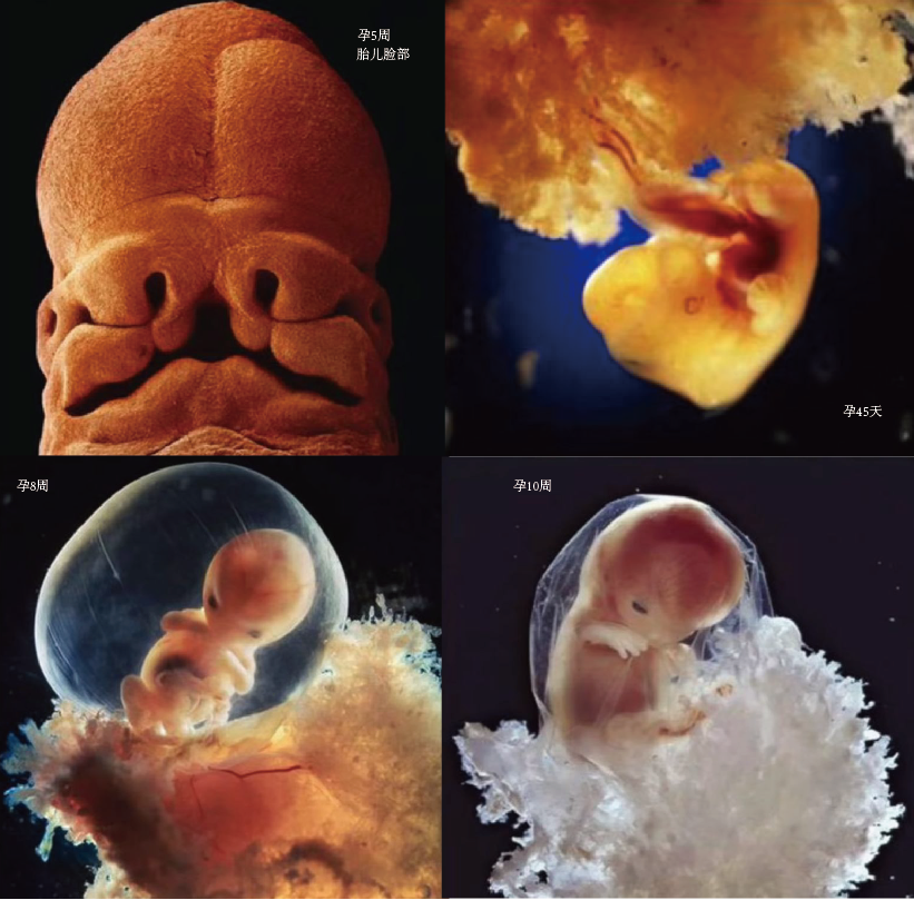⑤,一个月的胎儿,被羊水包裹,四肢和背脊开始慢慢生长