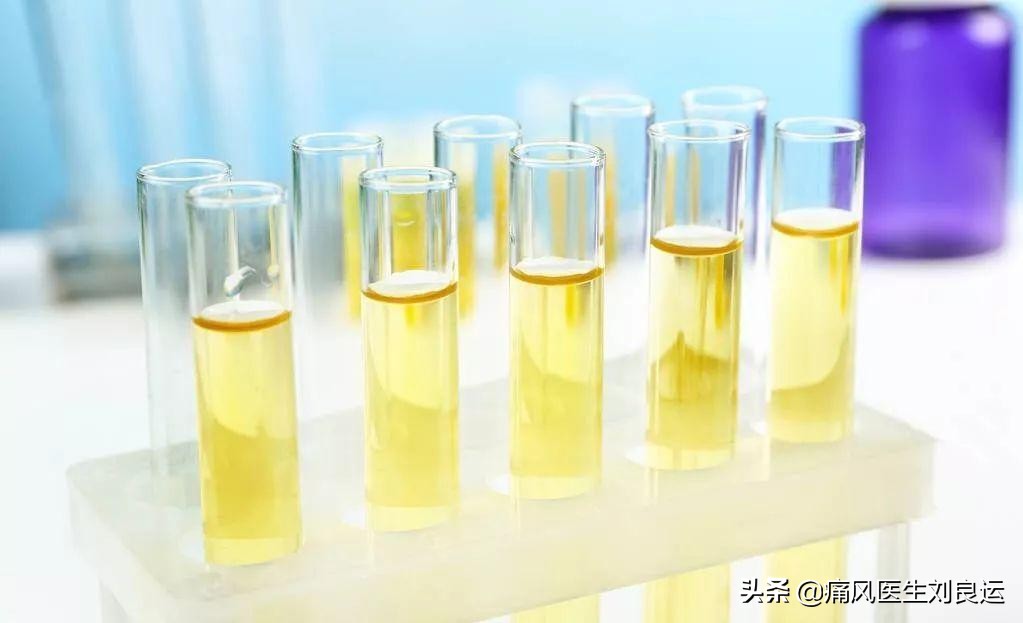痛风患者降尿酸选哪种药？七种方法分辨尿酸生成过多还是排泄减少