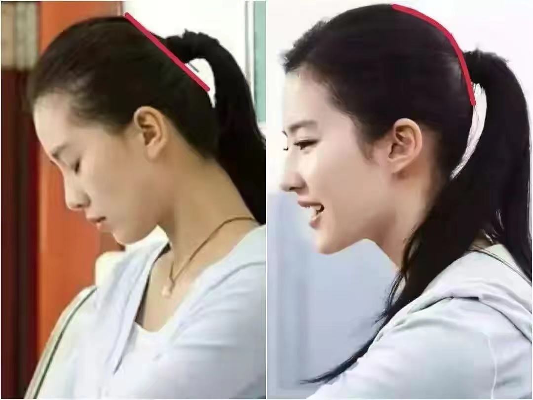 宝宝到底需不需要睡头型?看完刘亦菲和刘诗诗对张图,你就明白了