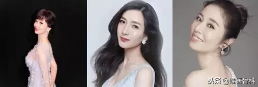 毁气质的 “脖子前倾”,明星也逃不过,医生送你4招拯救!