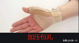 针刺治疗腱鞘囊肿的方法。