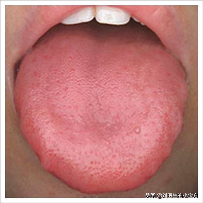 《中医舌诊》,9大体质舌诊图,看看你属于哪种?