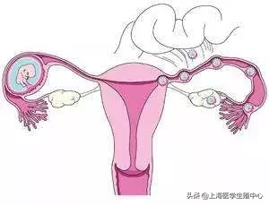 试管婴儿 | 对于不育不孕的患者,在什么情况下适合去做试管助孕?