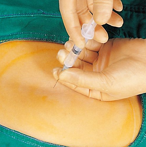 婴儿胎麻图片(图解产妇顺产全过程) - 乐宝宝贝