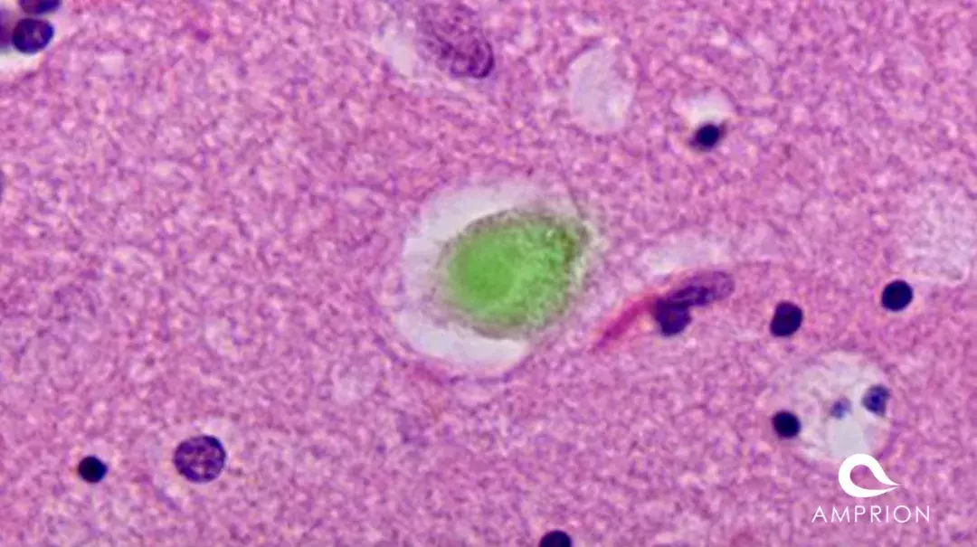 脑科学日报：人类微生物组整合计划完成；智能手套模拟人类触感
