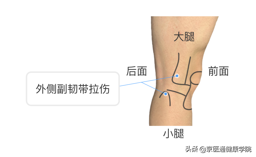 膝盖疼是什么病？积水潭专家教你1个动作判断