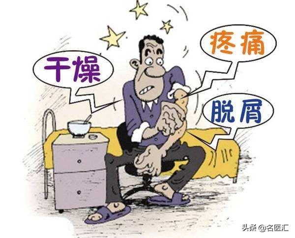 冬季银屑病肆虐，你对此了解多少呢？