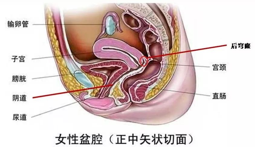 后穹窿图示图片