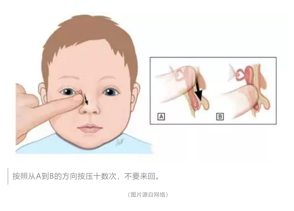 宝宝经常流眼泪、眼屎多，千万不容忽视