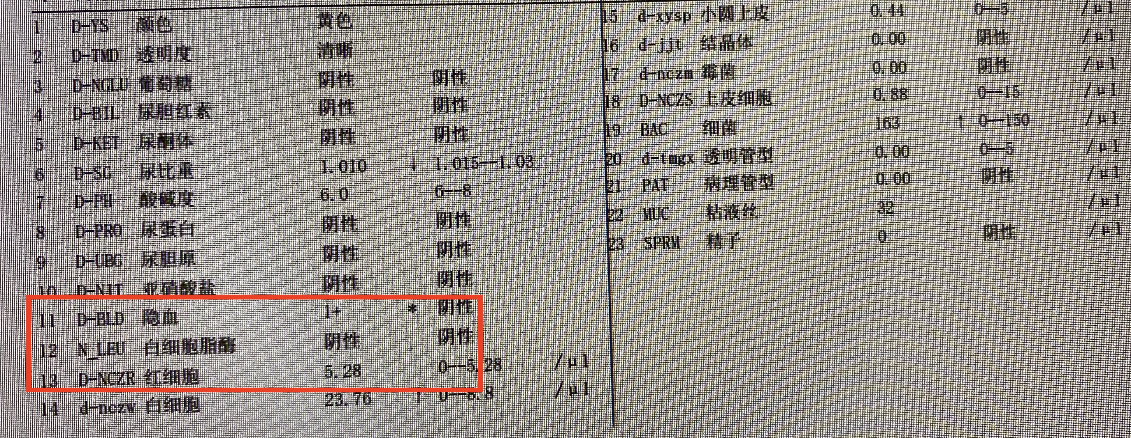 尿隐血3+但尿红细胞正常，是肾炎？还是尿常规结果出问题了吗？