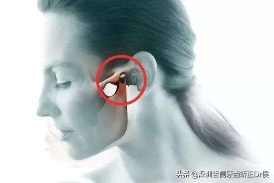 张嘴困难、咀嚼东西疼，小心，你可能是咬合紊乱