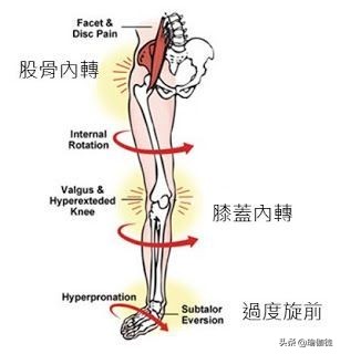 什么是扁平足？足弓是人体根基，常见的扁平足应该得到更多关注