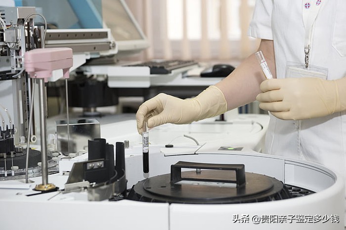 亲子鉴定需要什么,亲子鉴定需要什么材料和流程