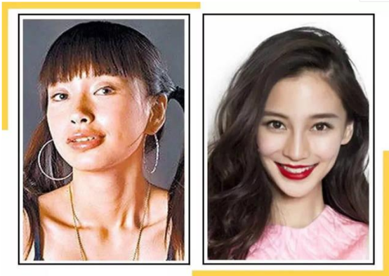 杨颖整容前(杨颖出道前"丑照"曝光,遭质疑整容,回应:当时确实很丑)