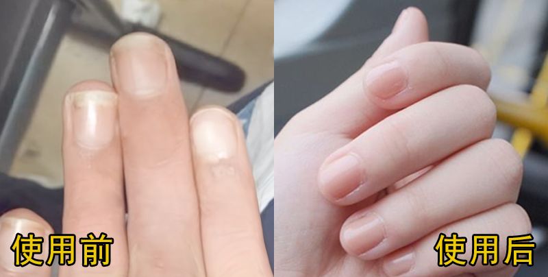 “值得敬佩”的德国制造，有126年历史的指甲刀！剪完不用磨