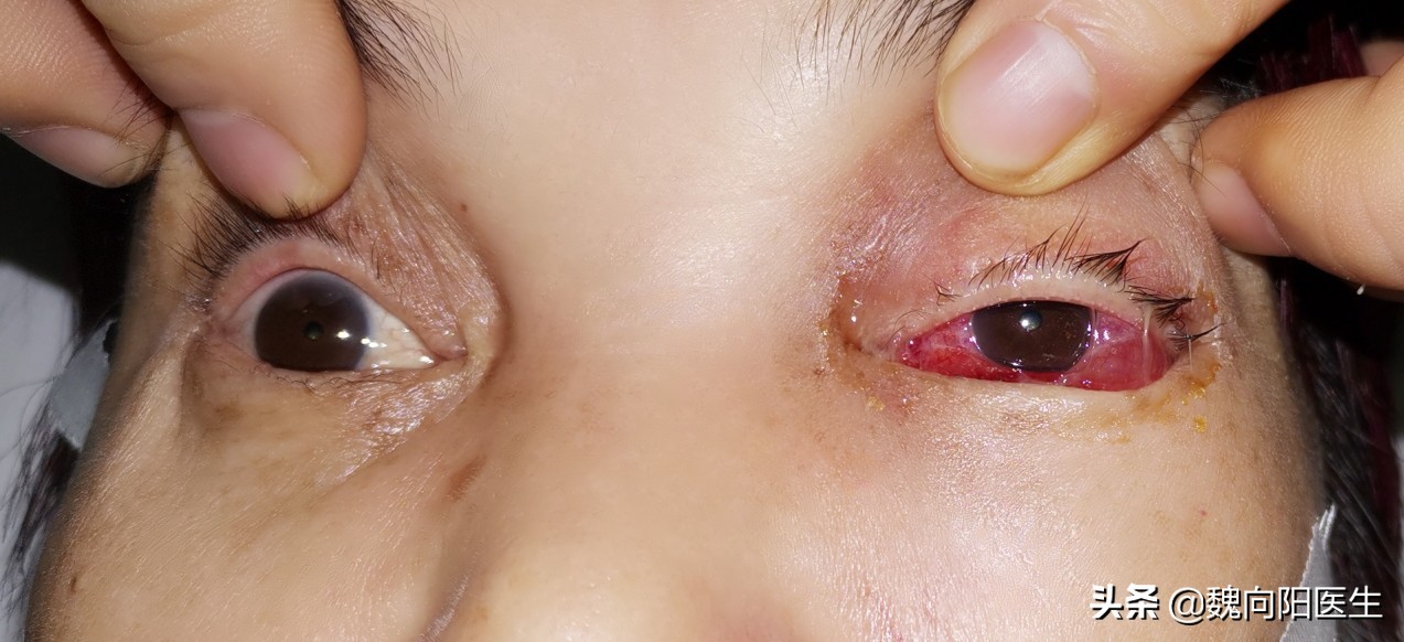 为什么最怕后脑勺着地