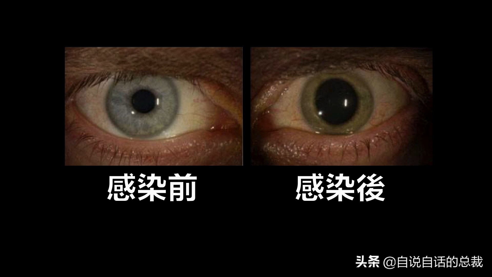 埃博拉：人类的诅咒，你的身体如何对抗它，它到底有多恐怖