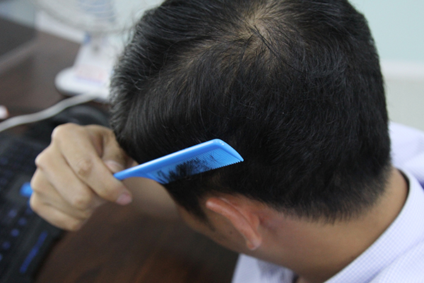 年过40头发半白，原因可能并非衰老，黑发变白发，你可以这样做