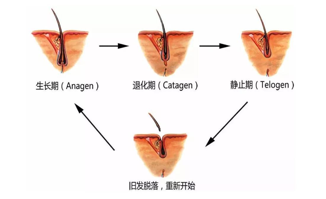 为啥新生儿有的头发，有的没头发？没头发的宝宝是发育晚吗？