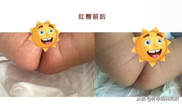 宝宝红屁屁，都是由家长护理不当引起，妈妈你知道吗？