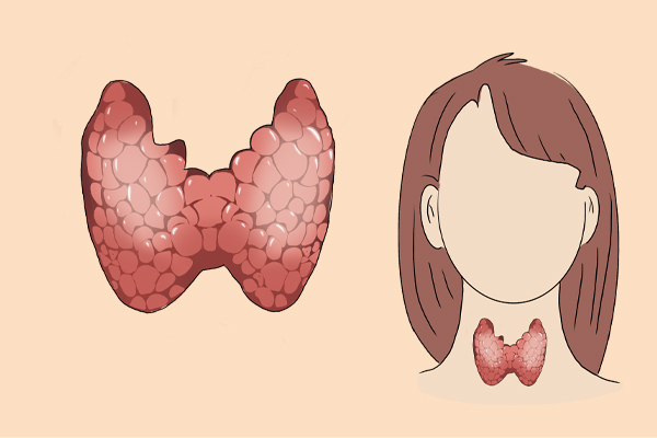 女性想做体检，但是又不知道应该查哪些项目？不妨看看本文