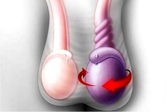 出现睾丸疼痛的原因，男性要如何保养睾丸？